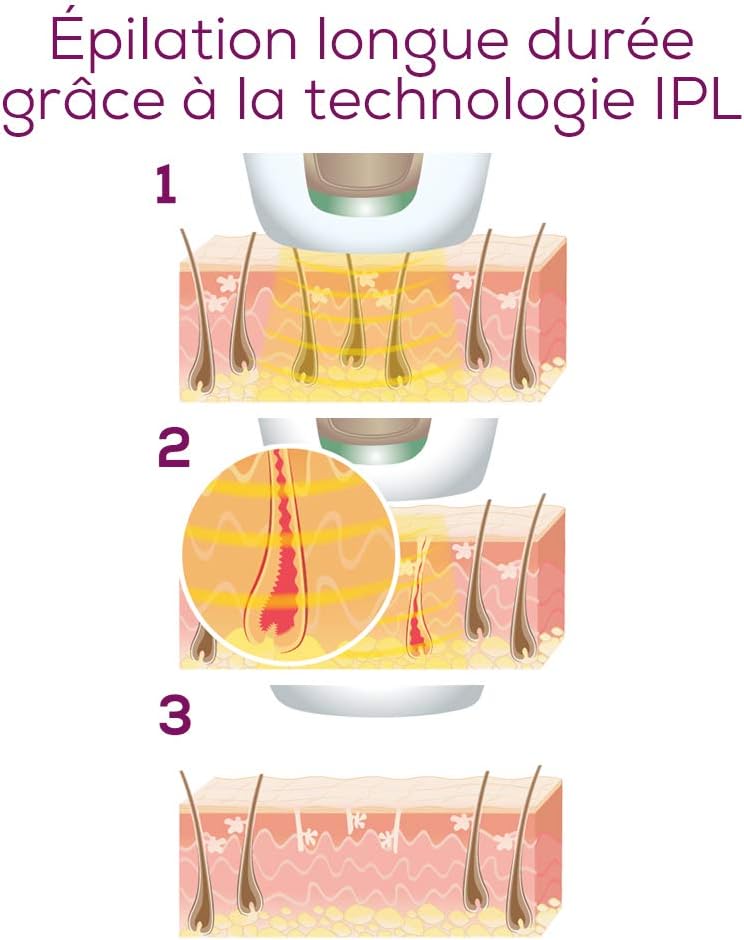 Velvet Skin IPL Pro Laser & IPL Hair Removal Devices Velvet Skin IPL Pro Velvet Skin IPL Pro Beurer